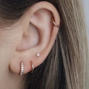 Aretes